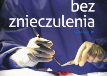 Bez znieczulenia